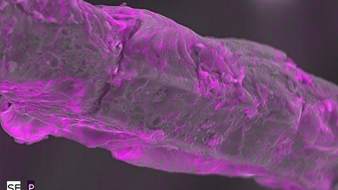 Phosphorverteilung an Faser