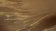 Spider sensory hair under microscope