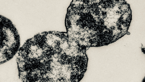 Two black circles, connected at one place with each other. The circles are filled with black substance that is distributed unequally. In the lower left corner, one can see writing with image name, etc.
