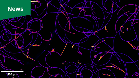 Ein Mikroskopiebild. Auf schwarzem Hintergrund bilden zahlreiche feine violette und orange-gelbe Fäden überlappende kreisförmige und gerade Muster. Während die meisten Fäden violett erscheinen, leuchten kürzere Segmente und Kurven in einem intensiven Orange-Gelb-Verlauf. Unten links befindet sich ein weißer Maßstabsbalken mit der Beschriftung „500 µm“. Ein grünes rechteckiges Banner mit dem weißen Wort „News“ ist in der oberen linken Ecke platziert.