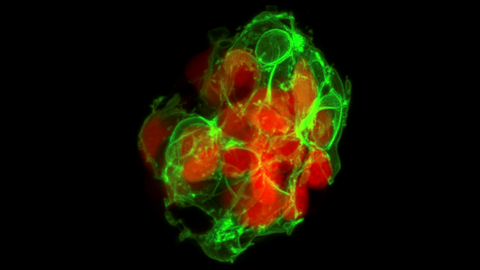 A microscopy image. The background is black. In the center, there is a cluster of semi-transparent red ovals with rounded edges. Bright green thread wraps around and weaves through the red ovals. The green threads form loops and curved lines of varying thickness. 
