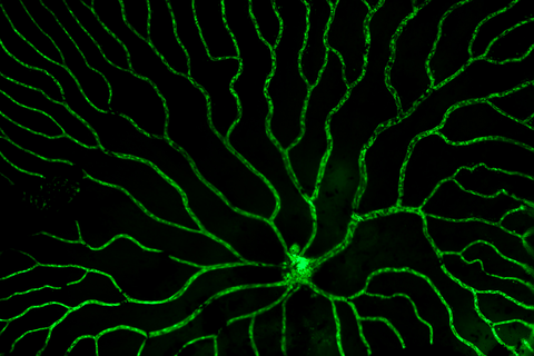 A microscopy image. The background is black. In the center of the image, there are bright green lines forming a branching network. They start from a single point at the bottom of the image. The green lines are unevenly distributed, with thicker branches near the center and thinner ones toward the edges.