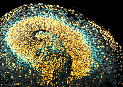 A microscopy image. The background is black. The image shows a spiral pattern of densely packed ovals in bright yellow and cyan. The structure mostly includes yellow ovals which form a distinct spiral from the center outward. Cyan-colored ovals are scattered throughout, especially along the outer edges of the spiral.