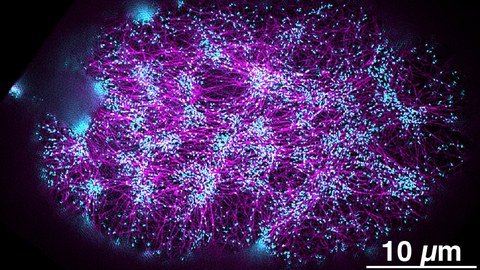 Super-resolution fluorescence image of the actomyosin cortex in a one-cell embryo. The actin filaments are labeled in magenta, and the regions where forces and torques are generated are labeled in cyan. 