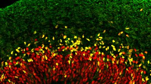 Neural progenitor cells of the developing neocortex. During neurogenesis, neural progenitor cells (SOX2/red; TBR2/yellow) give rise to neurons (TUJ1/green)