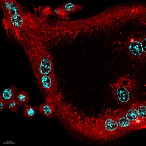 Confocal laser scanning microscopy of f-actin in in vitro differentiated polynucleated (DAPI in cyan) osteoclast (red) 