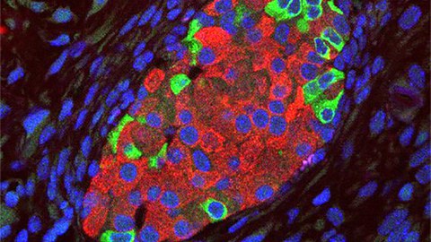 mouse pancreatic islet