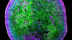 Immunostained image of a human retinal organoid section labeled for photoreceptors (RCVRN, magenta), Müller glia (RLBP1, green) and cell nuclei (DAPI, blue)