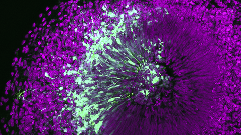 A microscopy image. Colorful, purple, fluorescent dots that radiate from a center and form a sphere, one part is interwoven with white and green dots.