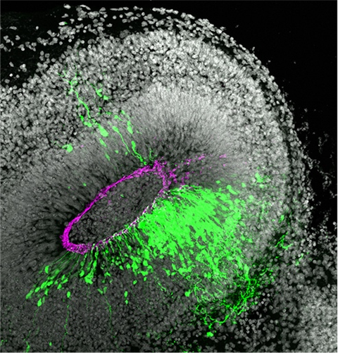 Mikroskop-Bild eine augenähnliche, meist schwarz-weiße Struktur, die aus weißen Punkten besteht. In der Mitte befindet sich ein magentafarbenes Oval. Außerhalb des magentafarbenen Ovals befinden sich grüne Farbkleckse.