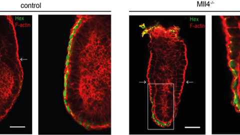Healthy (left) and defect (right) embryos on day 6.5 of embryonic development. Note the differences in the epithelium. The image section marked with the white rectangle is enlarged on the right. 
