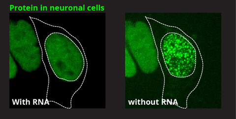 iPS cell-derived neural progenitors/ motor neurons with FUS protein (green) showing different distribution in presence and absence of ribonucleic acids
