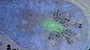 Correlative Light and Electron Microscopy of Actin in the intestinal crypt of a mouse. Overlay immunofluorescence and TEM image