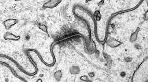 Desmosome
