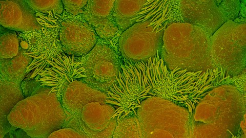 bronchiole