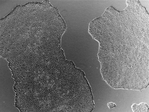 Colonies of the CRTDi004-A hiPSC line imaged with a phase contrast microscope.