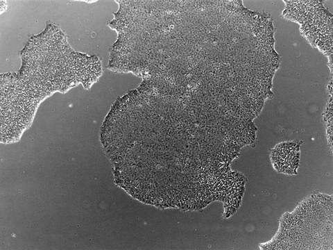 Colonies of the CRTDi005-B hiPSC line imaged with a phase contrast microscope.