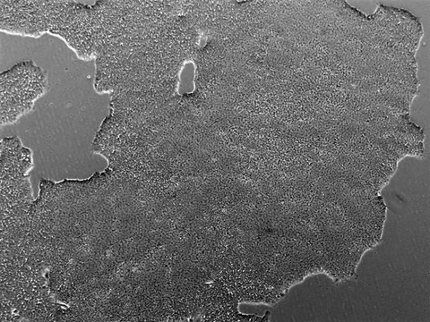 Colonies of the CRTDi005-A hiPSC line imaged with a phase contrast microscope.