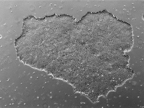 Phase Contrast image of CRTDi011-C hiPSC line