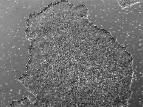 Phase Contrast image of CRTDi011-D hiPSC line