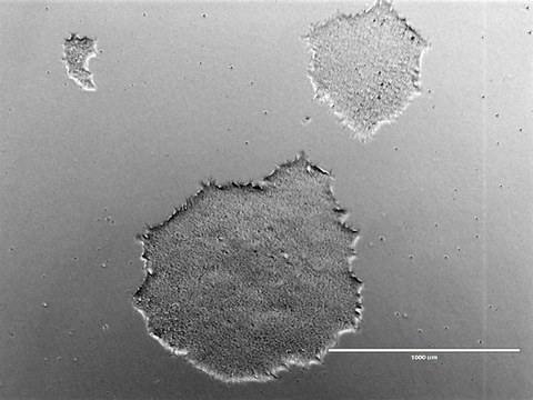 Colonies of the CRTDi003-A hiPSC line imaged with a phase contrast microscope.