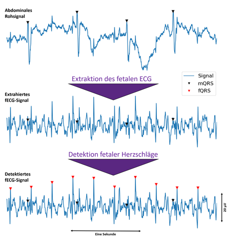 Abdominale_Signalaufnahme