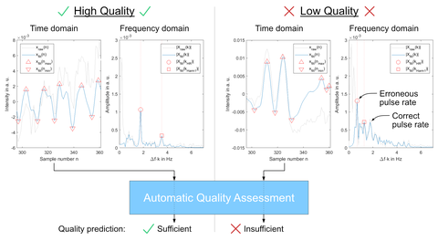 Principle of automatic quality assessment of cbPPG signals with a signal quality index filter