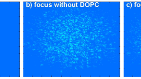 DOPC