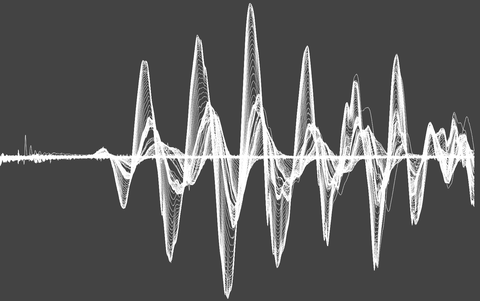 rsw-bannerbild 3 - ultraschallbild der ersten 200µs eines impulses