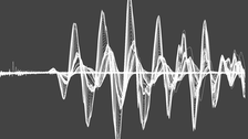 rsw-bannerbild 3 - ultraschallbild der ersten 200µs eines impulses