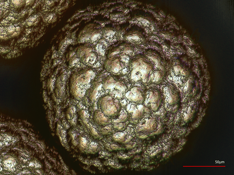 Microscopic image of a nickel particle
