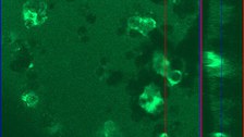 Laser Scanning Mikroskopie