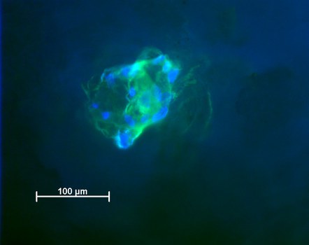 Fluoreszenzmikroskopie