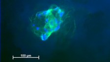 Fluoreszenzmikroskopie