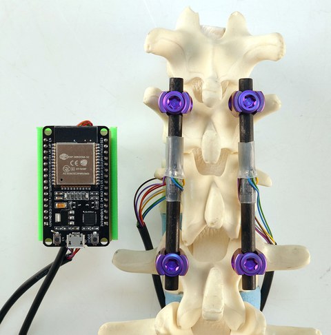 Left: rectangular device connected by cable to a model of a spinal column (right side of image). Two rods are attached to the left and right above three vertebrae. Small, colourful cables are attached to these.