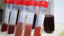 Extracted red Betalain