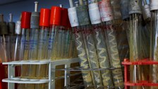 Viele Reagenzglasröhrchen mit Schrägagar-Kulturen im mikrobiologischen Praktikum