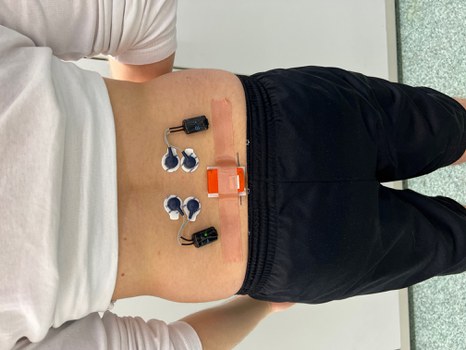 Inertialsensoren und Oberflächenelektromyographiesensoren (OEMG) am Rücken Höhe Lendenwirbelsäule