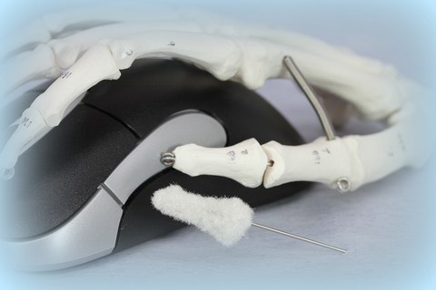 Implantat