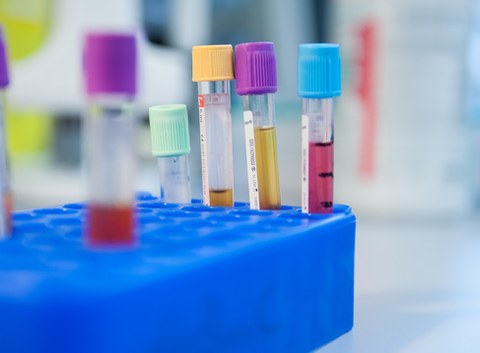 Flüssigproben auf Racks für Newsteil der BioBank Dresden