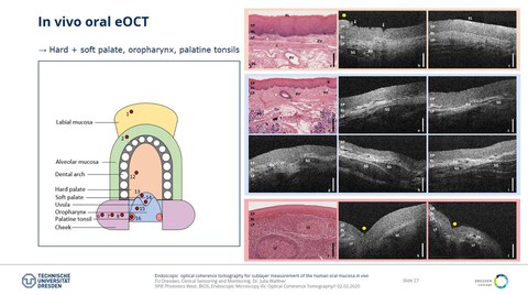 Das Bild zeigt eine Präsentationsfolie zur in vivo oralen eOCT.
