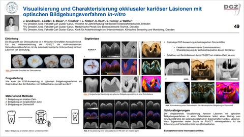 Das Bild zeigt ein Poster zum Thema Karies.