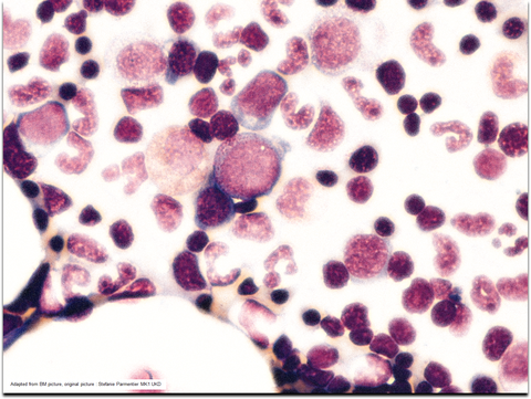 Bone-Marrow