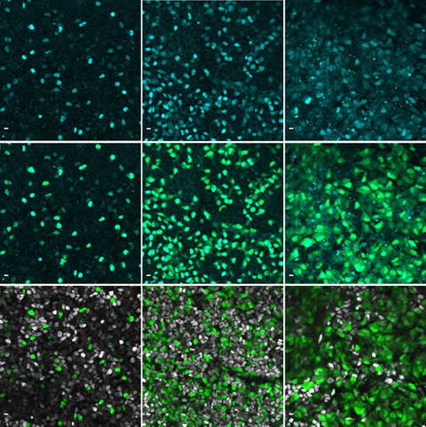 Immunofluorescence images showing the gene NEUROG3 in cyan in human pancreatic cells.
