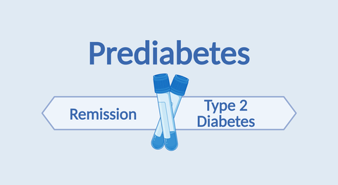 Two schematic blood plasma tubes are shown crossing each other on a light blue background. The word “Prediabetes” is written above them. Underneath, two arrow boxes point in different directions, labeled “Remission” and “Type 2 Diabetes”