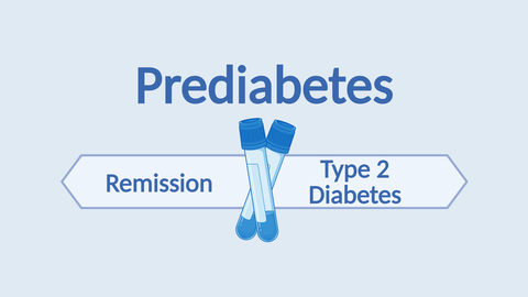 Two schematic blood plasma tubes are shown crossing each other on a light blue background. The word “Prediabetes” is written above them. Underneath, two arrow boxes point in different directions, labeled “Remission” and “Type 2 Diabetes”
