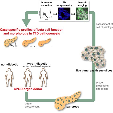 Graphical Abstract Panzer et a. JCI insights