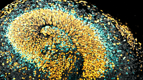 Mikroskopische Aufnahme eines Gehirnorganoids: spiralförmiges Objekt mit gelben und blauen Punkten.