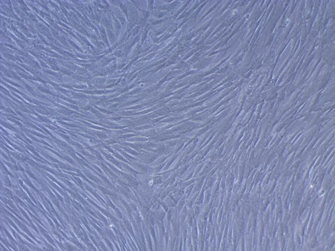 Die mesenchymalen Stromazellen werden aus dem gallertartigen, gefäßfreien Inneren der Nabelschnur von gesunden Neugeborenen gewonnen