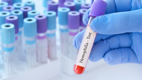 Hämophilie Darstellung